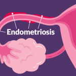 Unlocking the Hidden Pain of Endometriosis: A 21-Year-Old Endo-Warrior’s Story from South Africa.